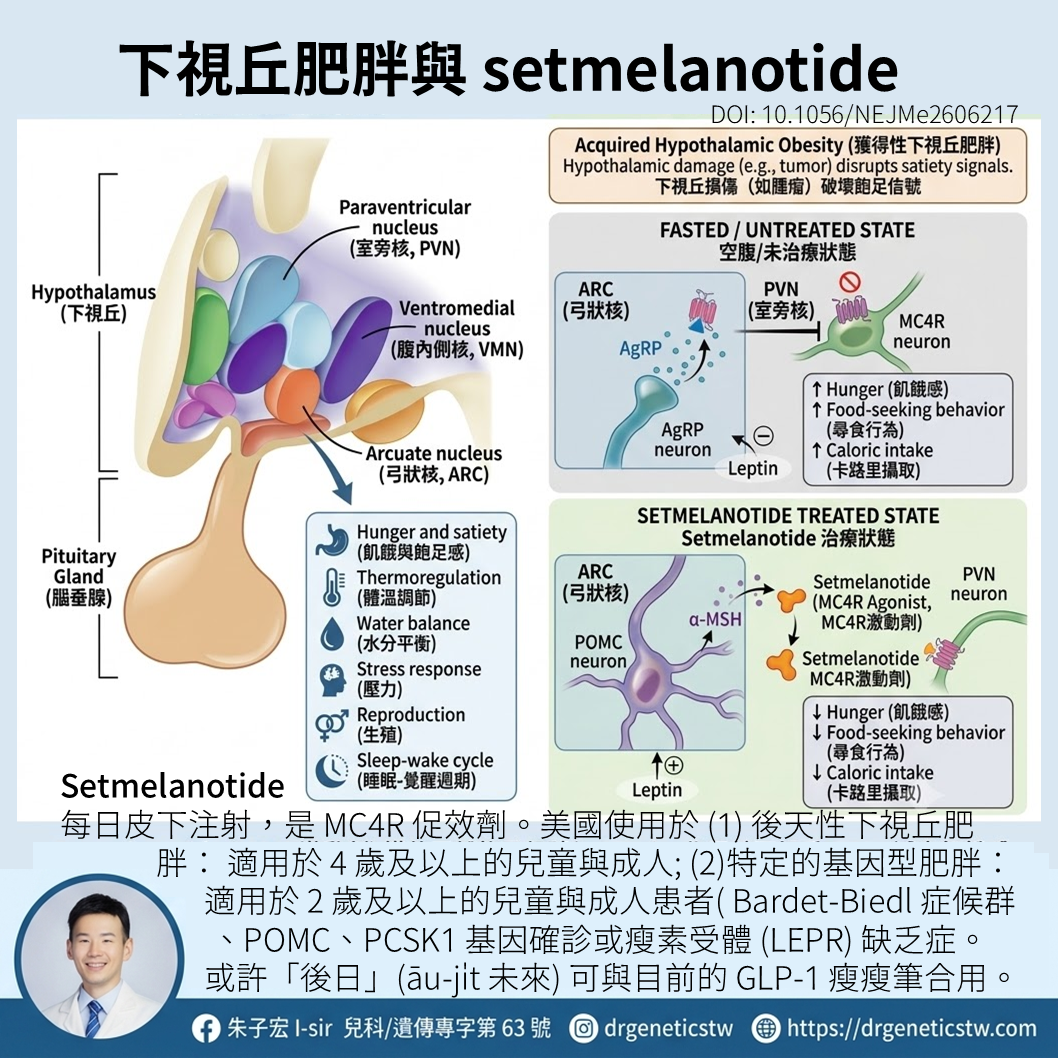 腦部開刀後卻一直胖嗎？認識「後天性下視丘肥胖」與新藥！