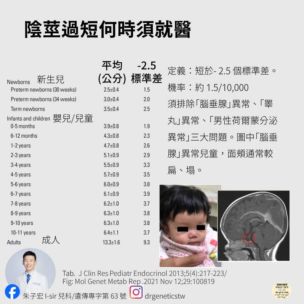 先天性陰莖短小：成因與治療全解析