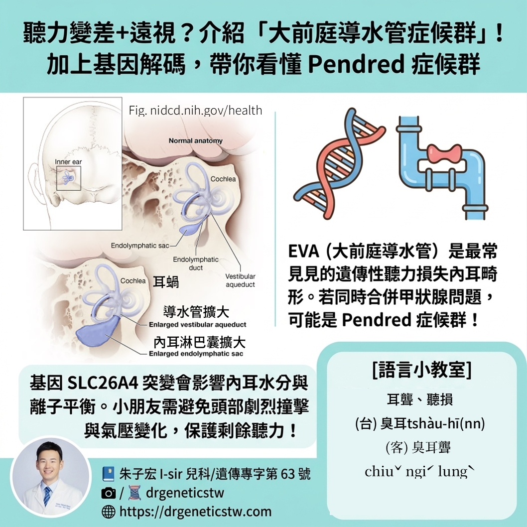 聽力異常又合併遠視?深入解析大前庭導水管症候群 (EVA) 與 Pendred 症候群